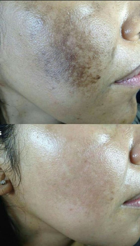 Oh So Glow - Brightening + Anti - Aging Cream - 50GM - PURETE Skin Co.