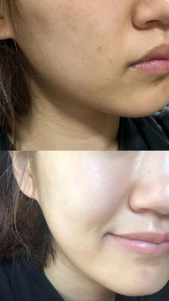 Oh So Glow - Brightening + Anti - Aging Cream - 50GM - PURETE Skin Co.